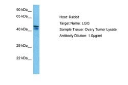 Lgi3 Rabbit anti-Human, Polyclonal, Novus Biologicals 0.1 mL | Buy Online | Novus Biologicals | Fisher Scientific